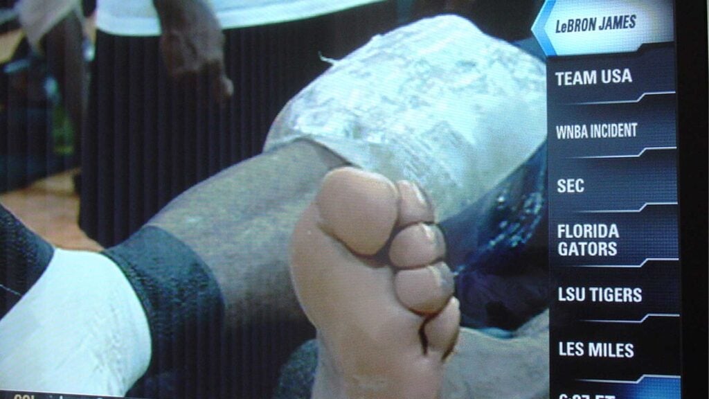 lebron james feet